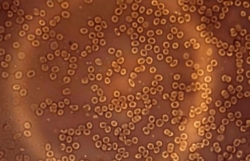 Ossido di Grafene, documenti USA desecretati: nel siero c'è, e fa male. Schermata 2023 07 06 Alle 09.50.22 250x161